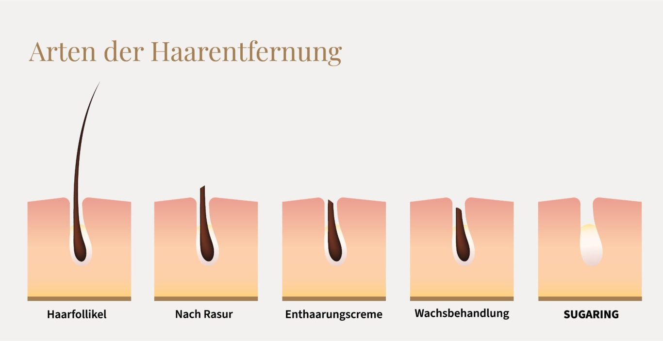 Haarentfernung Sugaring mit Zuckerpaste | Balance Wellnessmassagen und Sugaring in Flammersfeld